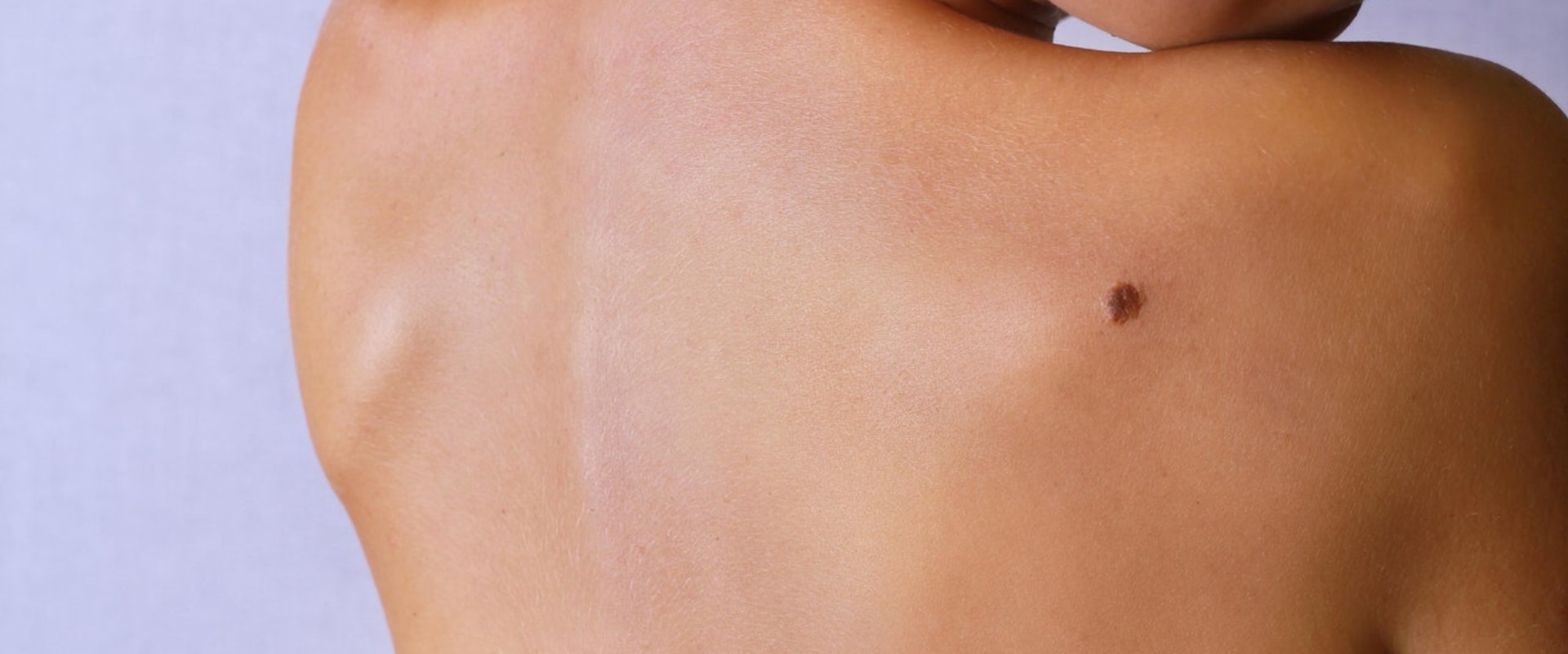 What Percentage of UV Rays Cause Skin Cancer?
